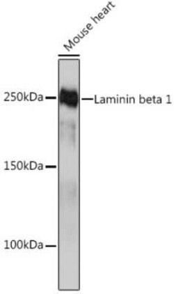 Laminin beta 1 Rabbit anti-Human, Mouse, Rat, Clone: 6I9T4, Novus Biologicals:Antibodies:Primary