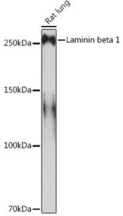 Laminin beta 1 Rabbit anti-Human, Mouse, Rat, Clone: 6I9T4, Novus Biologicals:Antibodies:Primary