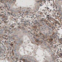 Laminin beta 1 Antibody (CL2970), Novus Biologicals:Antibodies:Primary