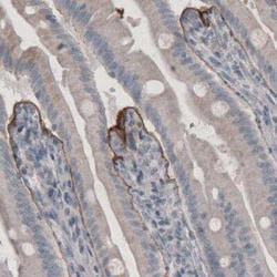 Laminin beta 3 Antibody (CL3363), Novus Biologicals:Antibodies:Primary