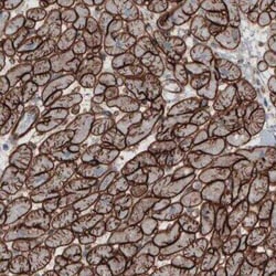 Laminin gamma 1 Antibody (CL3196), Novus Biologicals:Antibodies:Primary