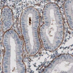 Laminin gamma 1 Antibody (CL3196), Novus Biologicals:Antibodies:Primary
