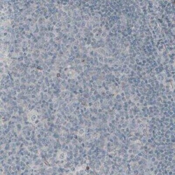 Laminin gamma 1 Antibody (CL3196), Novus Biologicals:Antibodies:Primary
