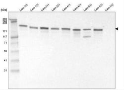 Laminin gamma 1 Antibody (CL3196), Novus Biologicals:Antibodies:Primary