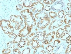 Laminin gamma 1 Antibody (SPM193), Novus Biologicals 0.1mg; Unlabeled:Antibodies,