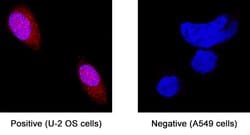 Human Laminin alpha 1 Antibody, R D Systems 25 &mu;g; Unconjugated:Antibodies,
