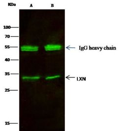 Latexin Rabbit anti-Human, Clone: 101, Novus Biologicals:Antibodies:Primary