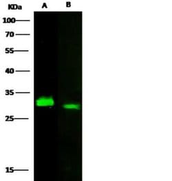 Latexin Rabbit anti-Human, Clone: 101, Novus Biologicals:Antibodies:Primary
