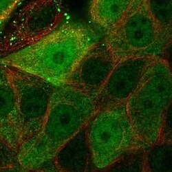 Latexin Antibody, Novus Biologicals:Antibodies:Primary Antibodies