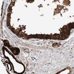 Latexin Antibody, Novus Biologicals:Antibodies:Primary Antibodies