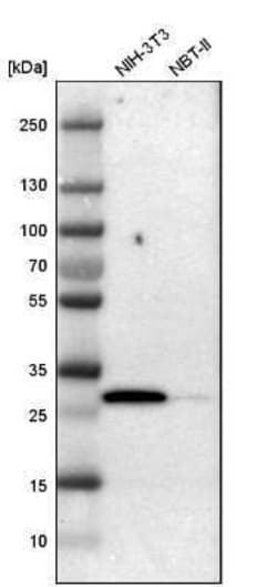 Latexin Antibody, Novus Biologicals:Antibodies:Primary Antibodies