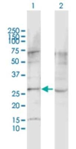 Novus Biologicals Latrophilin 1/LPHN1 Antibody, Novus Biologicals 0.1 mg | Buy Online | Novus Biologicals&trade; | Fisher Scientific