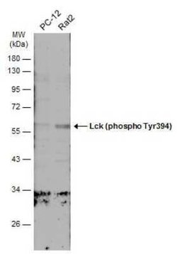 Lck, p Tyr394 Antibody, Novus Biologicals 100 &mu;g | Buy Online | Novus Biologicals | Fisher Scientific