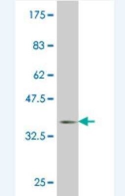 Lefty-1 Antibody (3B5), Novus Biologicals 0.1 mg | Buy Online | Novus Biologicals | Fisher Scientific