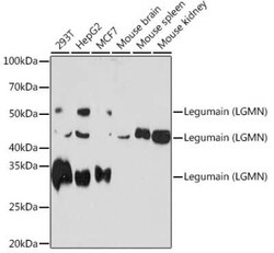 Legumain/Asparaginyl Endopeptidase Rabbit anti-Human, Mouse, Clone: 6X5U6, Novus Biologicals 100 &mu;g | Buy Online | Novus Biologicals | Fisher Scientific