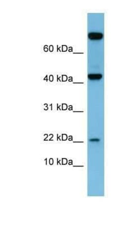 Leptin/OB Antibody, Novus Biologicals 100 &mu;g; Unconjugated:Antibodies,