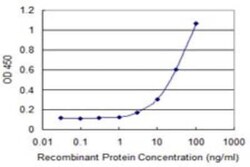 Novus Biologicals Leptin R Antibody (2H5), Novus Biologicals 0.1 mg | Buy Online | Novus Biologicals&trade; | Fisher Scientific