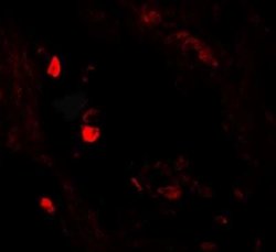 Leucyl-cystinyl Aminopeptidase/LNPEP Antibody - BSA Free, Novus Biologicals