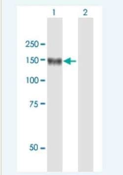 Novus Biologicals Leucyl-cystinyl Aminopeptidase/LNPEP Antibody, Novus Biologicals 50 &mu;g | Buy Online | Novus Biologicals&trade; | Fisher Scientific