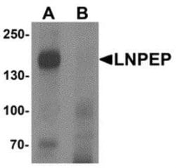 Leucyl-cystinyl Aminopeptidase/LNPEP Antibody - BSA Free, Novus Biologicals