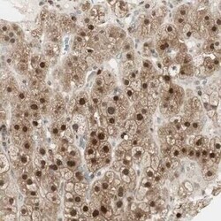 Leukotriene A4 Hydrolase/LTA4H Antibody, Novus Biologicals:Antibodies:Primary