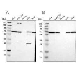 Leukotriene A4 Hydrolase/LTA4H Antibody, Novus Biologicals:Antibodies:Primary