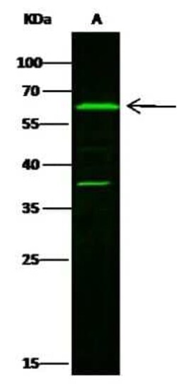 Leukotriene A4 Hydrolase/LTA4H Antibody, Novus Biologicals 100 &mu;g, Unconjugated:Antibodies,