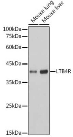 Leukotriene B4 R1 Rabbit anti-Mouse, Rat, Clone: 4R2X8, Novus Biologicals