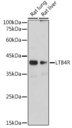 Leukotriene B4 R1 Rabbit anti-Mouse, Rat, Clone: 4R2X8, Novus Biologicals