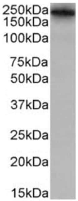 Lewis A,B Blood Group Antigens Rabbit anti-Human, Clone: HEA164, Novus Biologicals 0.2 mg | Buy Online | Bio-Techne | Fisher Scientific