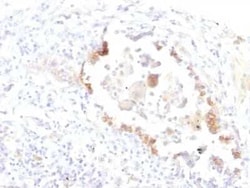Lewis Y Antibody (LWY/1463), Novus Biologicals 100&mu;g; Unlabeled:Antibodies,