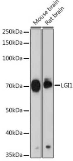 Lgi1 Rabbit anti-Human, Mouse, Rat, Clone: 2P8Z9, Novus Biologicals 20 &mu;g | Buy Online | Novus Biologicals | Fisher Scientific