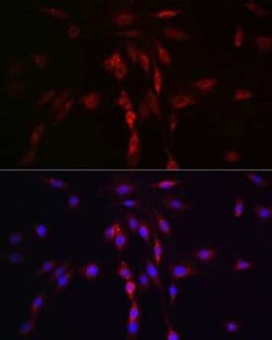 Lgl1 Rabbit anti-Human, Mouse, Rat, Polyclonal, Novus Biologicals 100 &mu;g | Buy Online | Novus Biologicals | Fisher Scientific