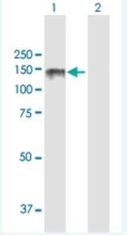 Lipin 2 Antibody, Novus Biologicals 50 &mu;g | Buy Online | Novus Biologicals | Fisher Scientific