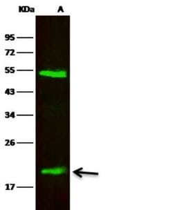 Lipocalin-2/NGAL Rabbit anti-Human, Clone: 128, Novus Biologicals:Antibodies:Primary