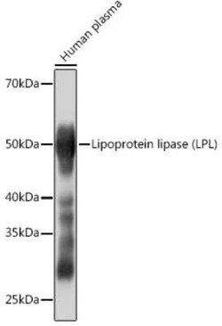 Lipoprotein Lipase/LPL Rabbit anti-Human, Mouse, Clone: 10E10P9, Novus