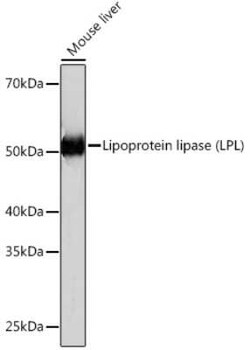Lipoprotein Lipase/LPL Rabbit anti-Human, Mouse, Clone: 10E10P9, Novus