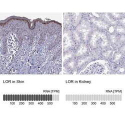Loricrin Antibody, Novus Biologicals 25ul; Unconjugated:Antibodies, Polyclonal