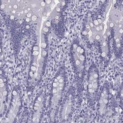 Loricrin Antibody, Novus Biologicals 25ul; Unconjugated:Antibodies, Polyclonal
