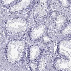 Loricrin Antibody, Novus Biologicals 25ul; Unconjugated:Antibodies, Polyclonal