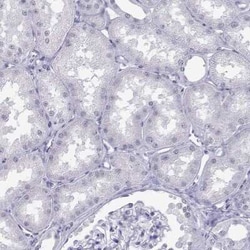 Loricrin Antibody, Novus Biologicals 25ul; Unconjugated:Antibodies, Polyclonal