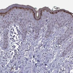 Loricrin Antibody, Novus Biologicals 25ul; Unconjugated:Antibodies, Polyclonal