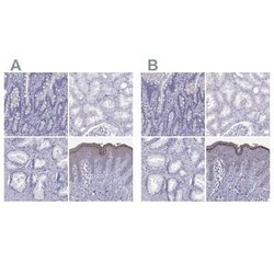 Loricrin Antibody, Novus Biologicals 25ul; Unconjugated:Antibodies, Polyclonal
