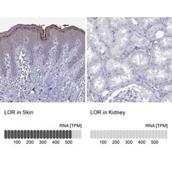 Loricrin Antibody, Novus Biologicals 25ul; Unconjugated:Antibodies, Polyclonal