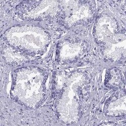 Loricrin Antibody, Novus Biologicals 25ul; Unconjugated:Antibodies, Polyclonal