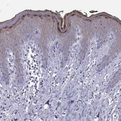 Loricrin Antibody, Novus Biologicals 25ul; Unconjugated:Antibodies, Polyclonal