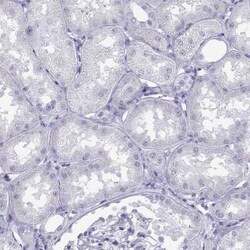 Loricrin Antibody, Novus Biologicals 25ul; Unconjugated:Antibodies, Polyclonal