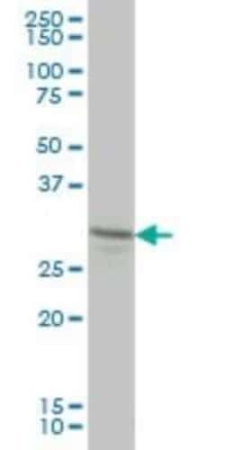 Novus Biologicals Lunatic Fringe Antibody (2D10-3C11), Novus Biologicals 0.1 mg | Buy Online | Novus Biologicals&trade; | Fisher Scientific