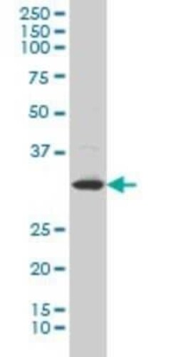 Lunatic Fringe Antibody (3D12), Novus Biologicals 0.1 mg | Buy Online | Novus Biologicals | Fisher Scientific