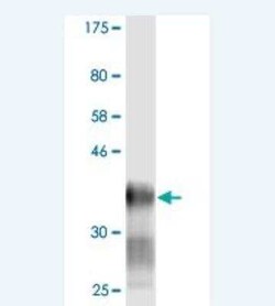 Novus Biologicals Ly-6H Antibody (1D1), Novus Biologicals 0.1 mg | Buy Online | Novus Biologicals&trade; | Fisher Scientific